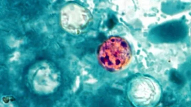 Epidemie de diaree în Statele Unite: Sursa focarului rămâne necunoscută
